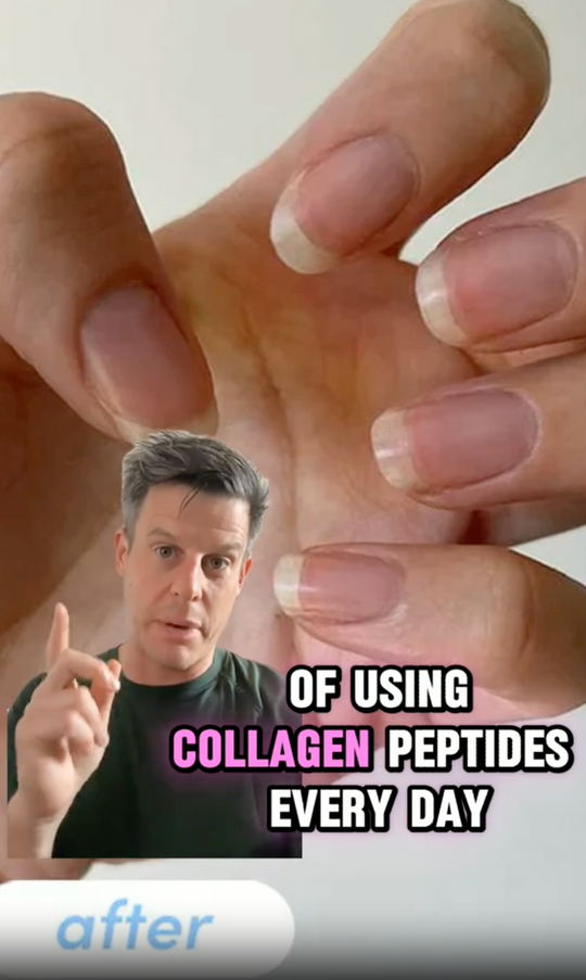 Nails before and after collagen 
