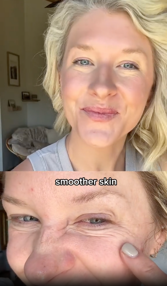 Smoother skin and nails with collagen