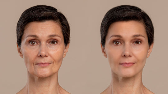 Before and after taking collagen